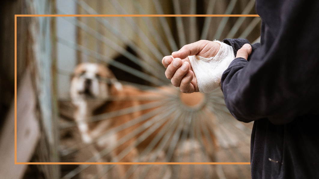 Injured Hand from Dog Bite – Contact a Dog Bite Lawyer Person clutching injured hand after a dog bite, in need of a dog bite lawyer.